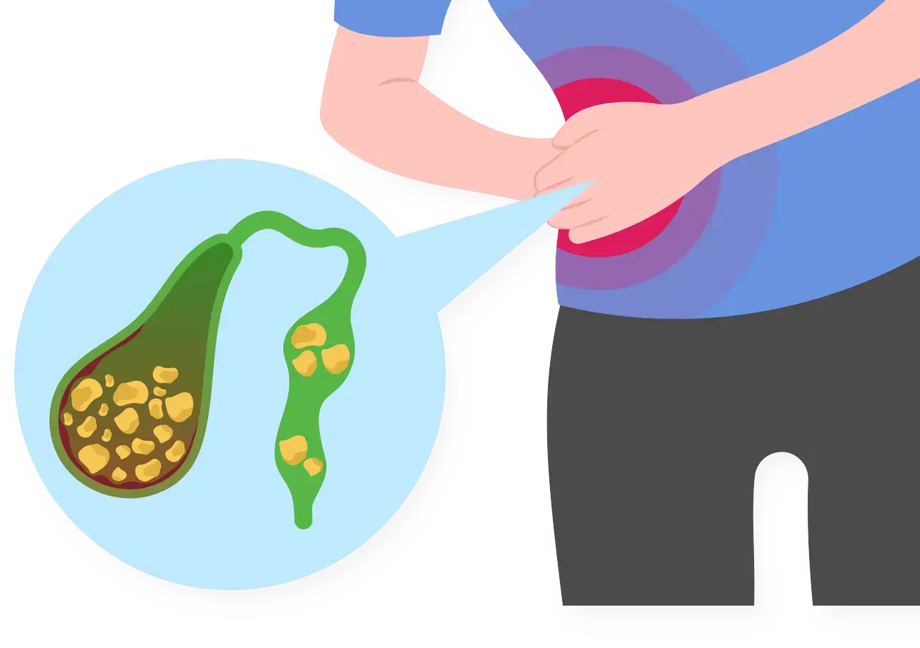 Gall Bladder Surgery