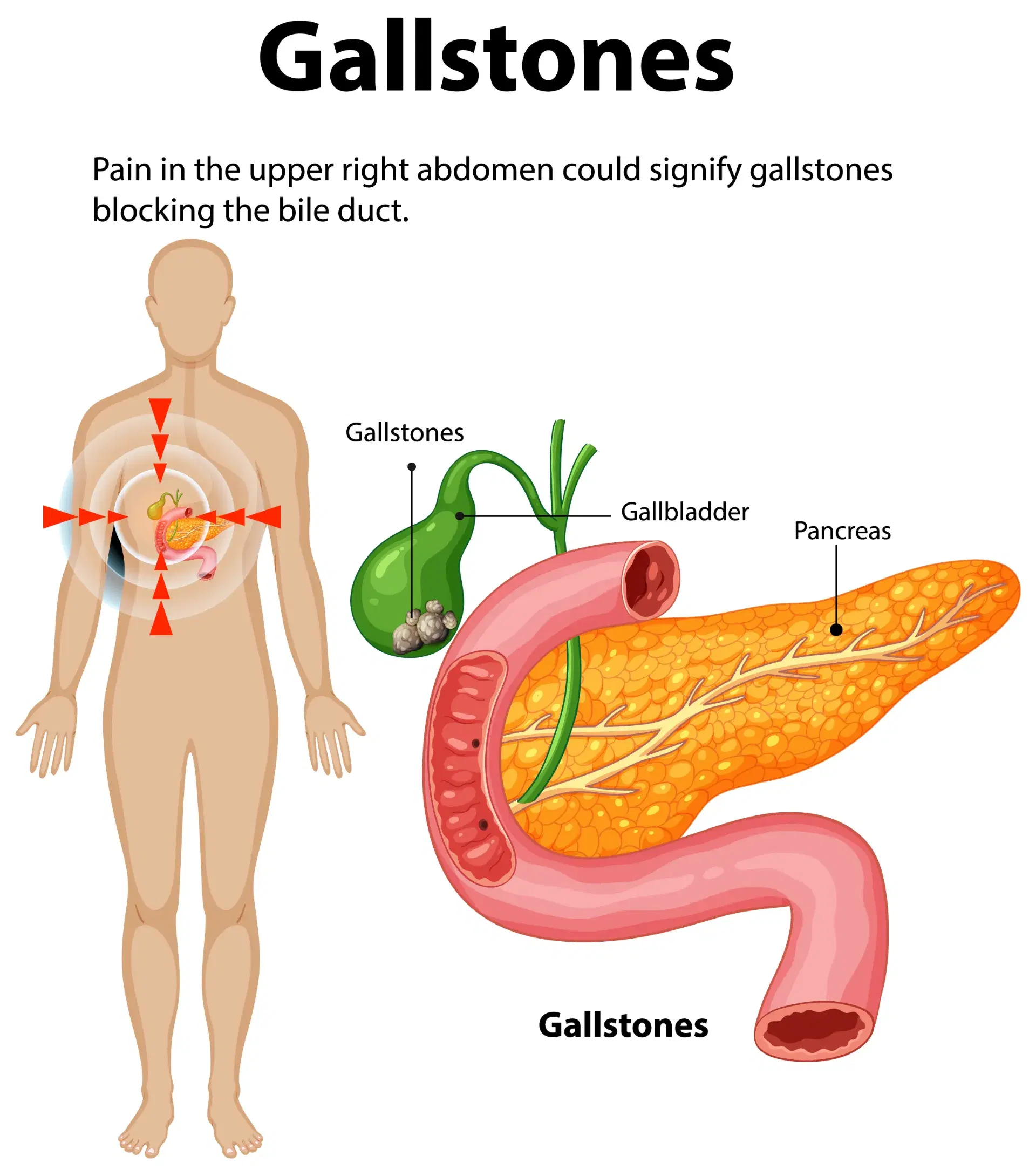 Gallstone Pain Relief: Symptoms & Treatment Options