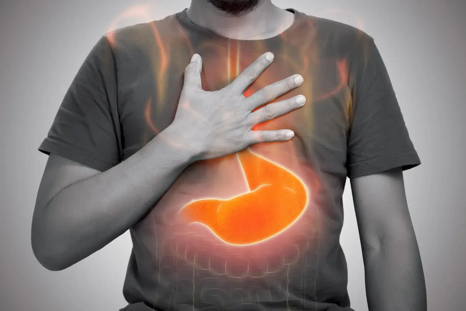 Why Does Acidity Happen? Understanding Acid Reflux Beyond Gas Trouble