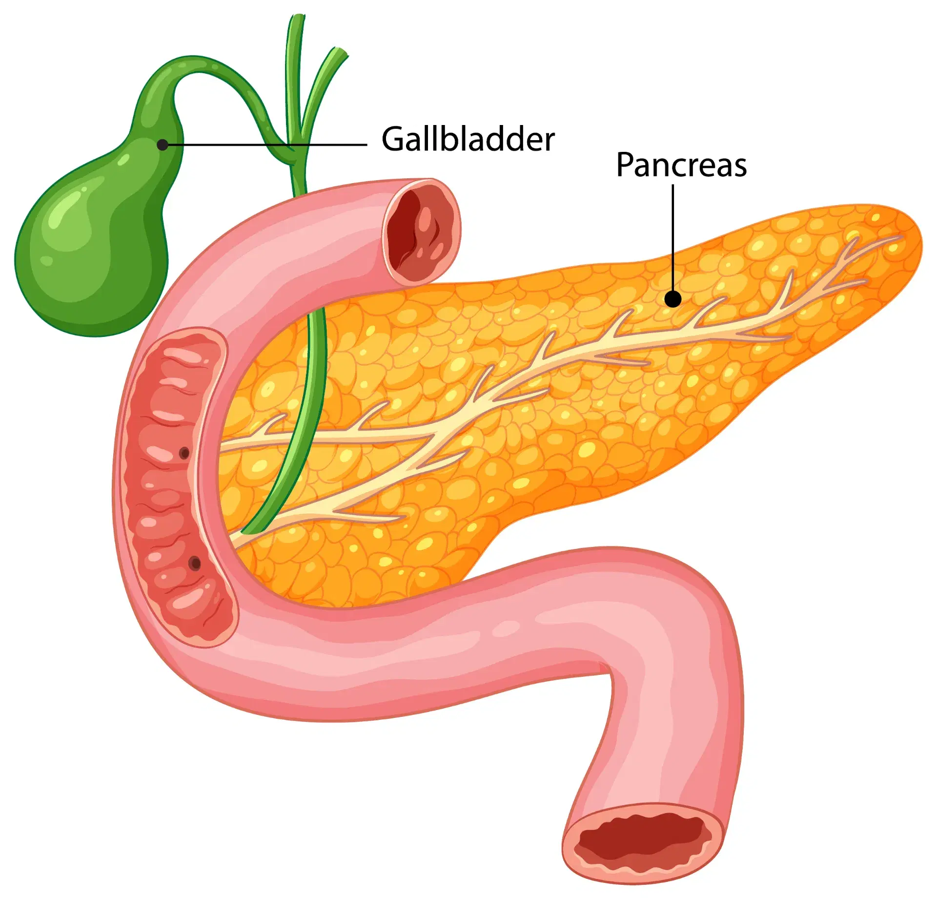 Pancreatic Enzyme Deficiency: Symptoms, Causes & Treatment Options Explained by Experts